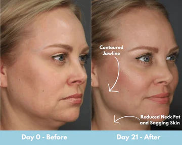 Facial sculpting CODE : GET 50%OFF